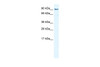 Antibody used in WB on Human Placenta at 0.2-1 ug/ml.