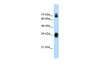 Antibody used in WB on Human HepG2 at 1 ug/ml.