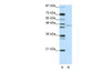 Antibody used in WB on Human Jurkat cells at 2.5 ug/ml.