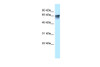 Antibody used in WB on Human Jurkat 0.2-1 ug/ml.