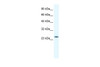 Antibody used in WB on Human Jurkat cells at 0.2-1 ug/ml.