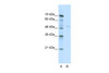 Antibody used in WB on Human Jurkat 0.2-1 ug/ml.