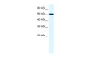 Antibody used in WB on Human HepG2 at 0.2-1 ug/ml.