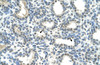 Antibody used in IHC on Human Lung.