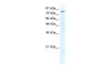 Antibody used in WB on Human HepG2 at 1.25 ug/ml.