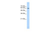 Antibody used in WB on Human HepG2 at 1.25 ug/ml.