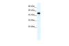 Antibody used in WB on Human HepG2 at 1.25 ug/ml.