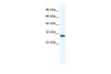 Antibody used in WB on Human HepG2 at 1.25 ug/ml.