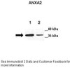 Antibody used in WB on Mouse at: 1:250 (Lane 1: 20ug mouse GL261 cell lysate, Lane 2: 20ug mouse astrocyte cell lysate) .