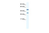 Antibody used in WB on Human Placenta at 0.2-1 ug/ml.