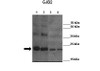 Antibody used in WB on Lane 1: 4ug mCx26 elution fraction 6 Lane 2: 4ug mCx26 elution fraction 7Lane 3: 4ug mCx26 elution fraction 6 + other Cx26 antibody Lane 4: 4ug mCx26 elution fraction 7 + other Cx26 antibody at 1:3000 (Lane 1: 4ug mCx26 elution fraction 6 Lane 2: 4ug mCx26 elution fraction 7Lane 3: 4ug mCx26 elution fraction 6 + other Cx26 antibody Lane 4: 4ug mCx26 elution fraction 7 + other Cx26 antibody ) .