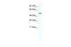 Antibody used in WB on Human Lung at 0.2-1 ug/ml.