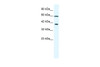 Antibody used in WB on Human Daudi cells at 2.5 ug/ml.