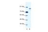 Antibody used in WB on Human Jurkat 0.125 ug/ml.