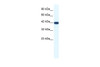 Antibody used in WB on Human HepG2 at 1.25 ug/ml.