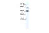 Antibody used in WB on Human Thymus at 2.5 ug/ml.