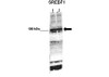 Antibody used in WB on mouse glomerular endothelial at 1:1000 (Lane 1: 50ug mouse glomerular endothelial lysate Lane 2: 50ug mouse glomerular endothelial lysate ) .
