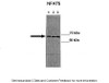 Antibody used in WB on HT-29 at: 1:1000 (Lane 1: 20ug HT 29 lysate blocked with 5% FBS Lane 2: 20ug HT 29 lysate blocked with no FBS Lane 3: 20ug HT-29 lyaste blocked with no PBS + 100 mM NaCl ) .