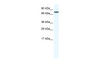 Antibody used in WB on Mouse SP2/0 at 1.25 ug/ml.
