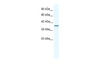 Antibody used in WB on Human Jurkat cells at 2.5 ug/ml.