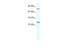 Antibody used in WB on Human Jurkat 2.5 ug/ml.