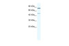 Antibody used in WB on Human Jurkat 1.25 ug/ml.