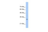 Antibody used in WB on Human HepG2 at 0.2-1 ug/ml.