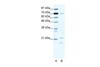 Antibody used in WB on Human Jurkat cells at 1.25 ug/ml.