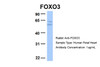 Antibody used in WB on Hum. Fetal Heart at 1 ug/ml.