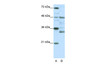 Antibody used in WB on Human HepG2 at 0.2-1 ug/ml.