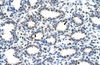 Antibody used in IHC on Human Lung at 16 ug/ml.