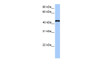 Antibody used in WB on Human HeLa at 0.2-1 ug/ml.