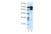 Antibody used in WB on Human HepG2 at 1.25 ug/ml.