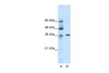 Antibody used in WB on Human Jurkat 2.5 ug/ml.