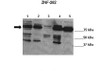 Antibody used in WB on Bewo c, HEK, JEG3, PC3, SHEP at: 1:1000 (Lane 1: 20ug Bewo cells Lane 2: 20ug HEK cells Lane 3: 20ug JEG3 cells Lane 4: 20ug PC3 cells Lane 5: 20ug SHEP cells ) .