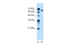 Antibody used in WB on Human HepG2 at 2.5 ug/ml.