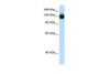 Antibody used in WB on Transfected 293T at 2.5 ug/ml.