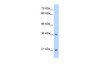 Antibody used in WB on Human Jurkat 2.5 ug/ml.