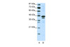 Antibody used in WB on Human Jurkat 0.2-1 ug/ml.