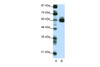 Antibody used in WB on Transfected 293T at 0.2-1 ug/ml.