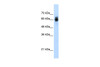 Antibody used in WB on Transfected 293T at 1.25 ug/ml.