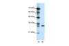 Antibody used in WB on Human Jurkat 1.25 ug/ml.