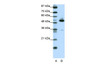 Antibody used in WB on Transfected 293T at 0.2-1 ug/ml.