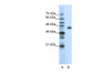 Antibody used in WB on Human HepG2 cells at 1.25 ug/ml.