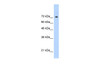 Antibody used in WB on Recombinant STAT1 protein at 5 ug/ml.