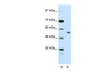 Antibody used in WB on Human Jurkat 2.5 ug/ml.