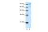 Antibody used in WB on Human Daudi at 5.0 ug/ml.