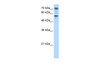 Antibody used in WB on Human Jurkat 0.2-1 ug/ml.