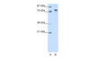 Antibody used in WB on Transfected 293T at 1.25 ug/ml.