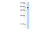 Antibody used in WB on Human Jurkat 1.25 ug/ml.